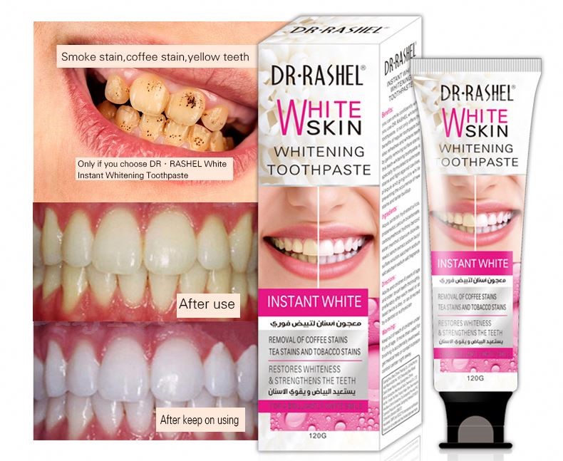 خمیر دندان سفید کننده فوری دکتر راشل