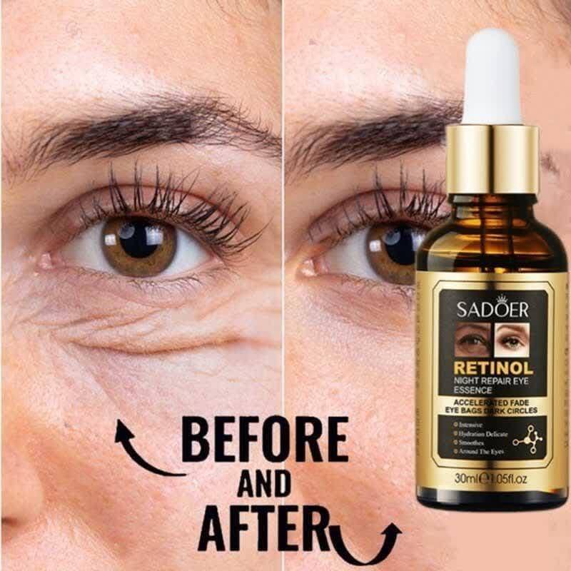 سرم دور چشم رتینول سادور