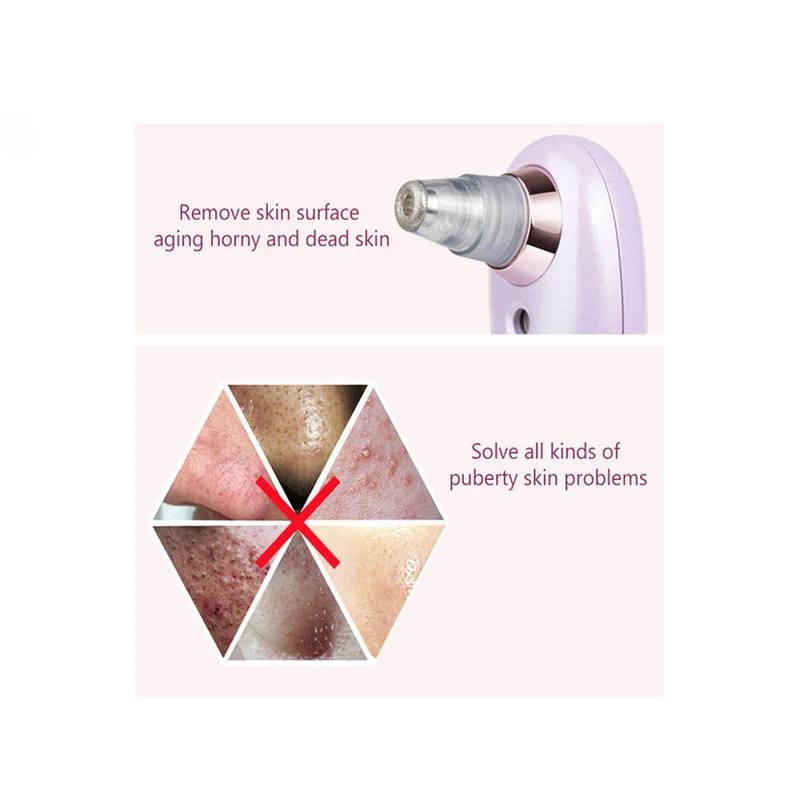 دستگاه میکرودرم بخور دار باراباس مدل 2700