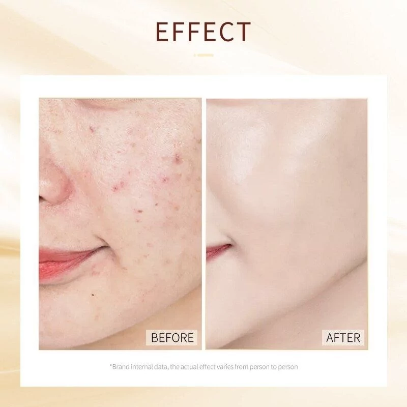 ماسک خواب تخصصی حلزون LAIKOU ساشه ای Snail Sleeping Mask